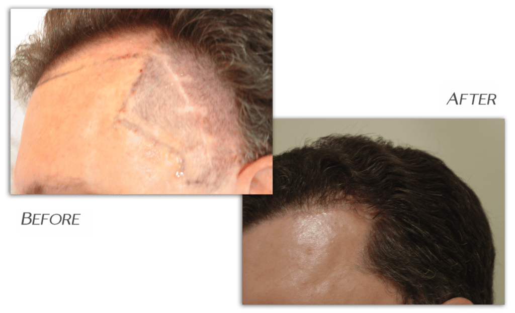 Armani Medical - Repairs Before & After
