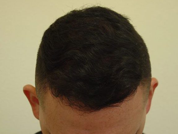 after-1_mod