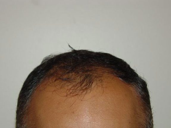 before-AK-mod